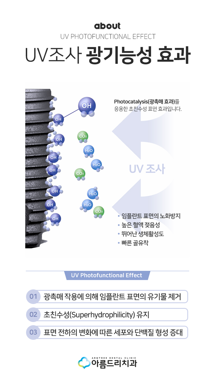 UV임플란트 더욱 완벽하게 관련 이미지 4