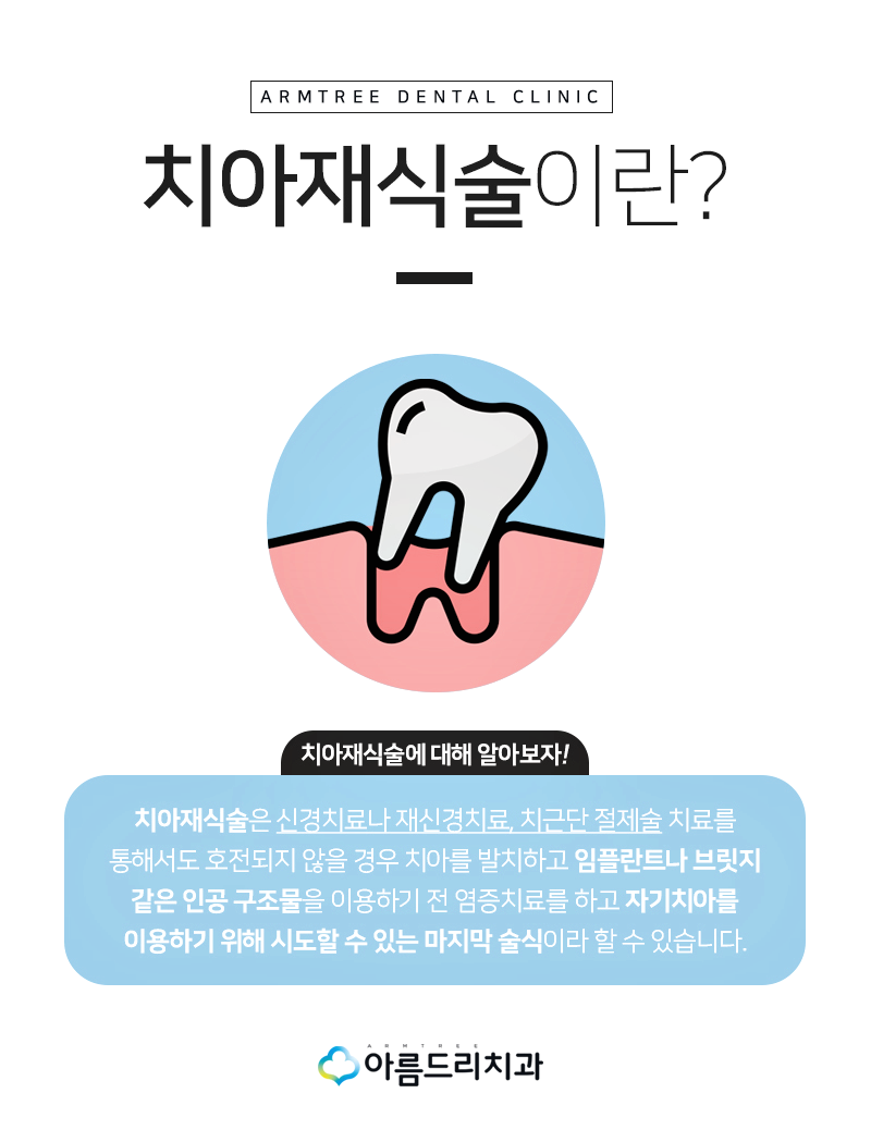 치아재식술 자연치아를지키는 방법 관련 이미지 5