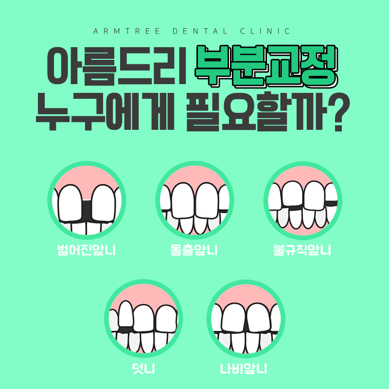 앞니벌어짐 교정 부분교정 후기가 말한다 관련 이미지 5