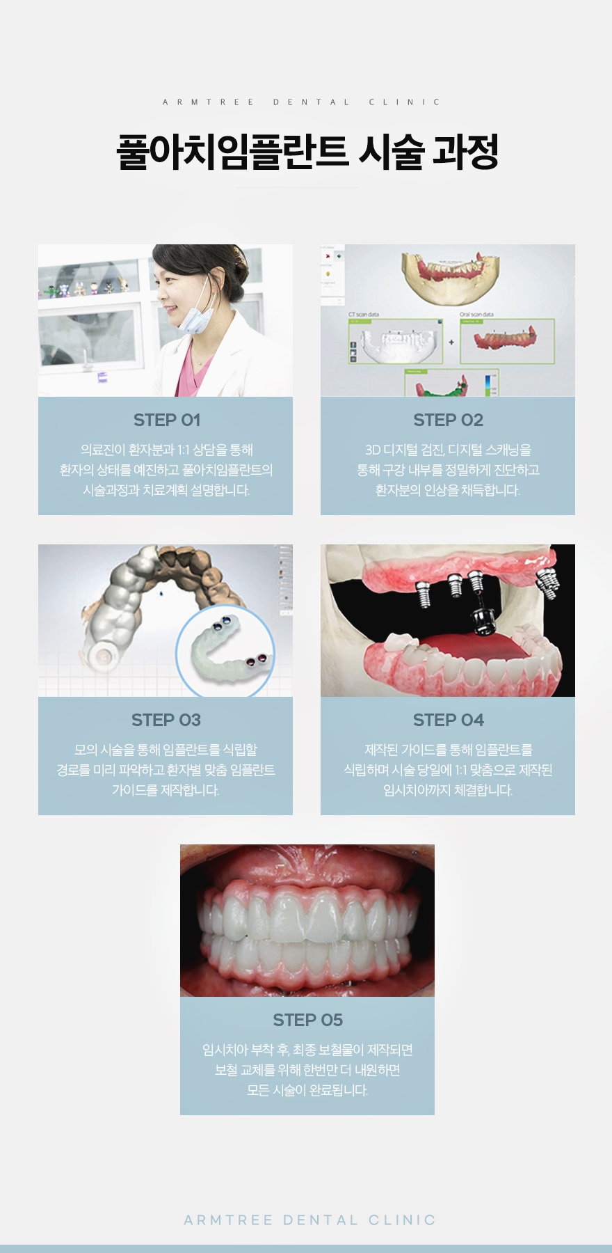 신논현역 전체임플란트는 풀아치임플란트로 관련 이미지 6