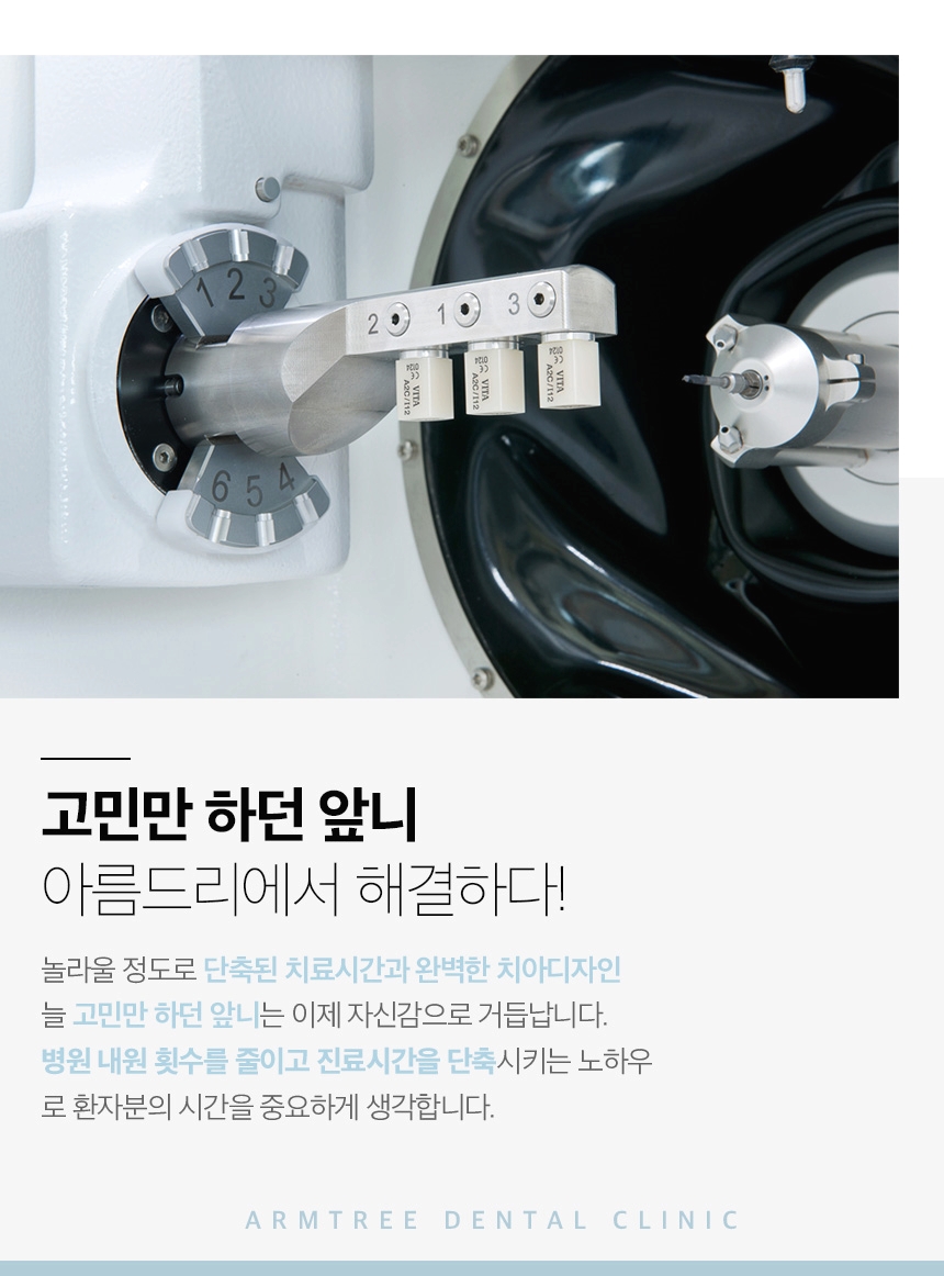 연예인라미네이트 신중하게 확인사항을 관련 이미지 8
