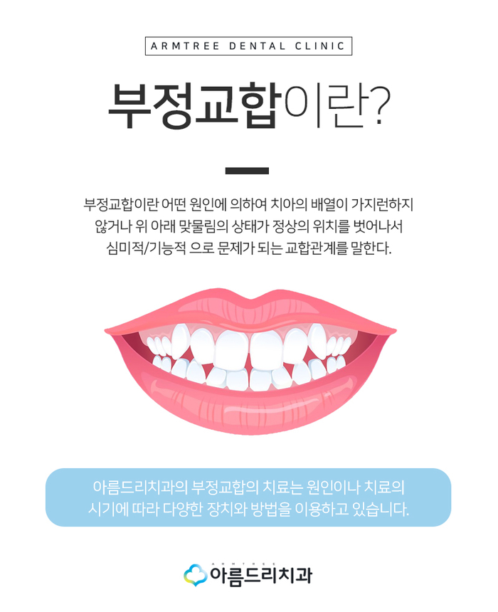 치아 부정교합교정 꼭 필요한 이유 관련 이미지 3
