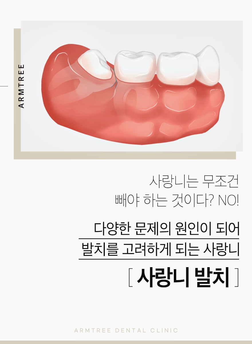 신논현역 사랑니발치는 체계적인 아름드리치과 관련 이미지 2