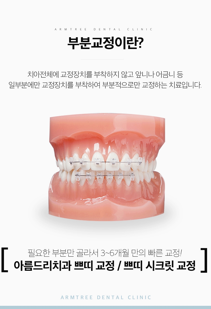 치아교정종류 신뢰가는 신논현역치과 관련 이미지 3