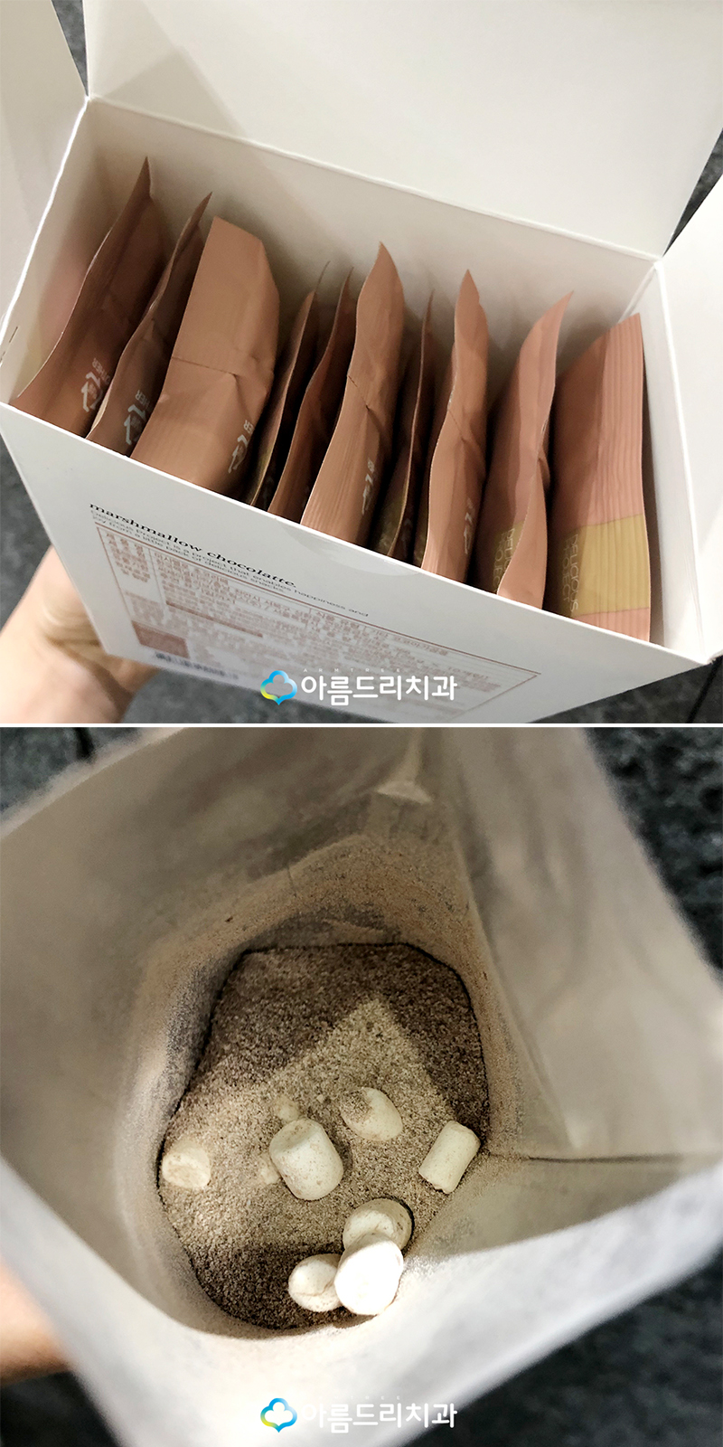 클리피시교정 후기 환자의 선물 관련 이미지 2