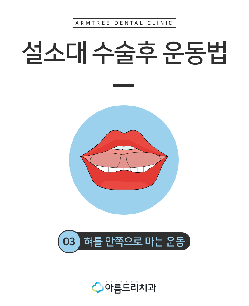 설소대수술 - 실제후기로 보는 확연한 차이 관련 이미지 12