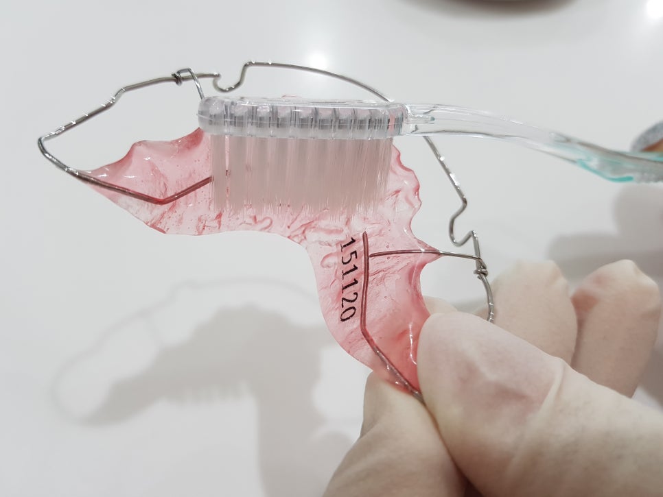 치아교정 후 유지 장치 세척&관리법 Tip_강남 아름드리 치과 관련 이미지 12