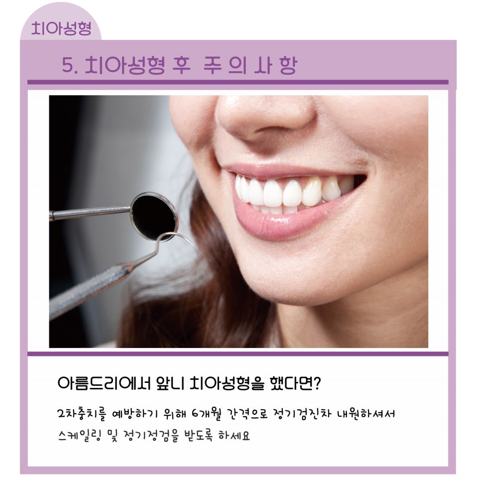 라미네이트,올세라믹으로 연예인치아 (주의사항)_아름드리치과 관련 이미지 20