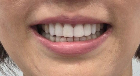 테일러 비니어 (진료일기) 관련 이미지 15