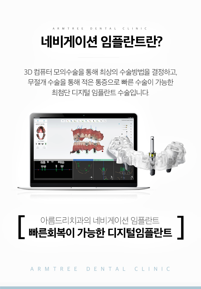 신논현역치과 임플란트 고민이라면 관련 이미지 3