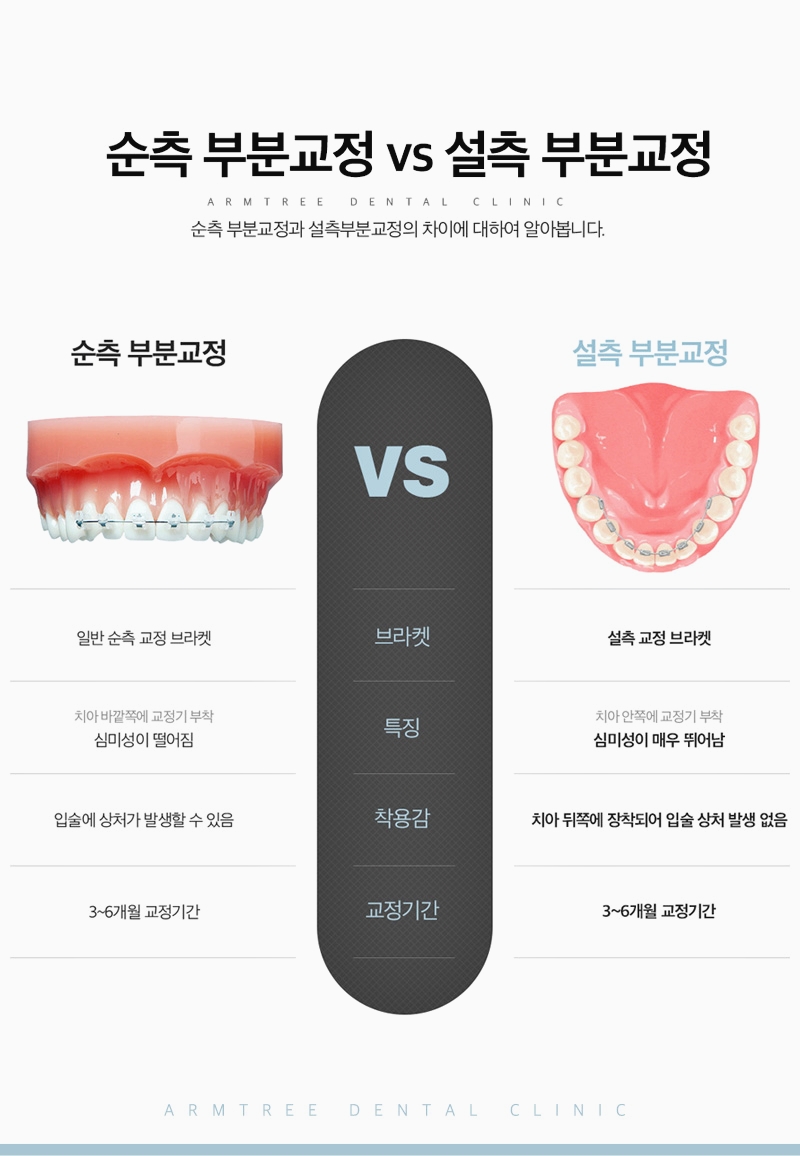 돌출앞니부분교정은 신논현역 아름드리치과에서 관련 이미지 6