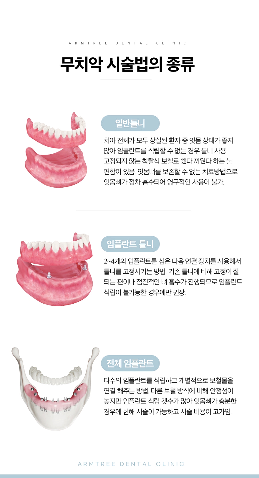 신논현역치과 전체임플란트가 궁금하다면 관련 이미지 4