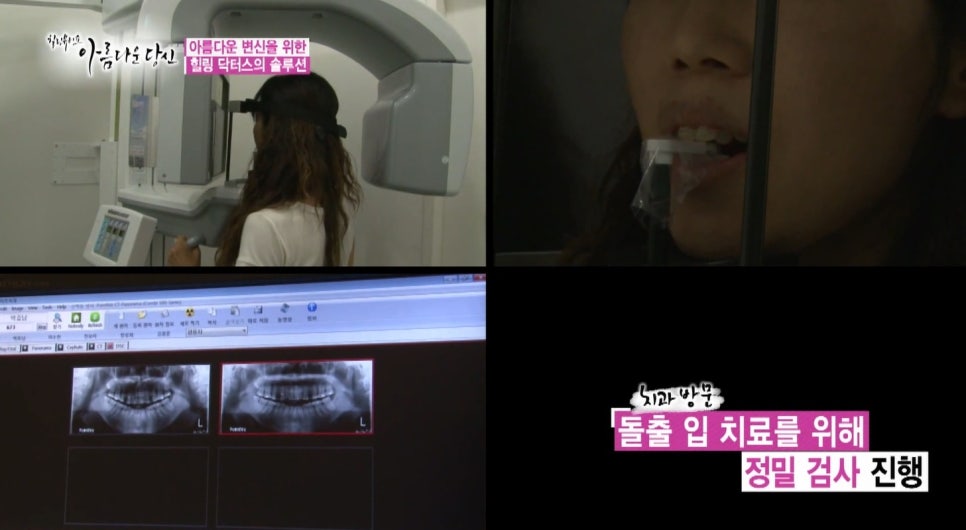 이현정원장의 아름다운 당신 시즌 1(4회 박효남 도전자) 돌출입 치아교정 관련 이미지 5