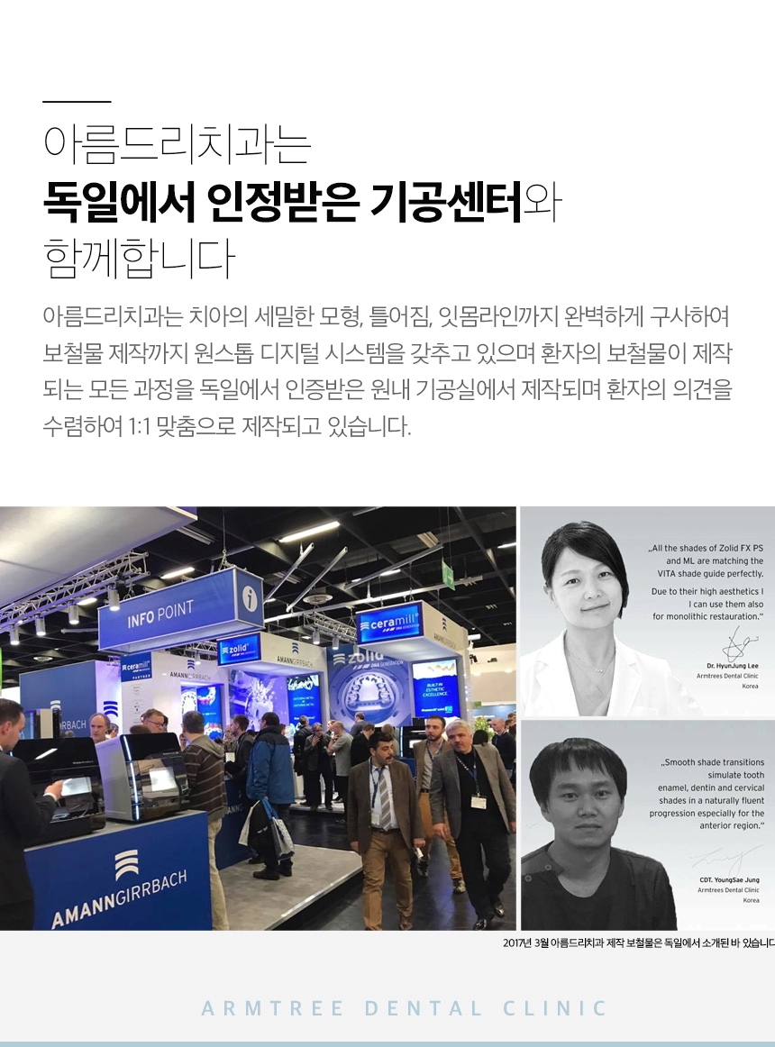 연예인라미네이트 신중하게 확인사항을 관련 이미지 10