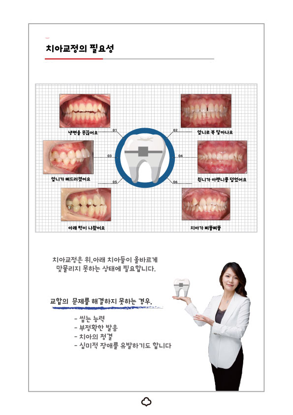치아교정 후 유지 장치 세척&관리법 Tip_강남 아름드리 치과 관련 이미지 16