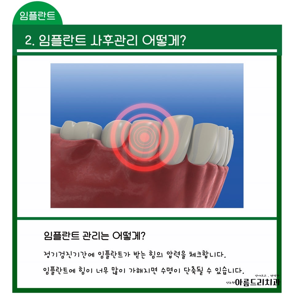 신논현역 치과_임플란트 지켜야 할 주의사항!!!_아름드리 치과 관련 이미지 4