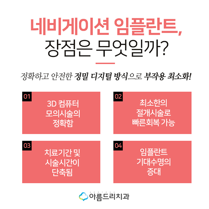 디지털인플란트 치아인플란트 정확도 차이 관련 이미지 5