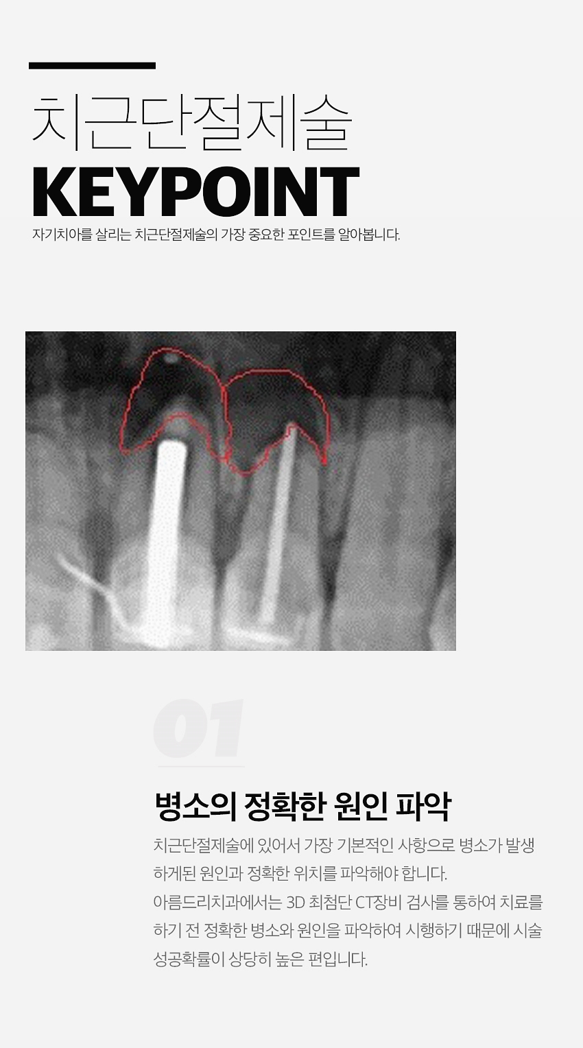 치근단절제술 염증 신뢰있는 후기 아름드리치과 관련 이미지 6