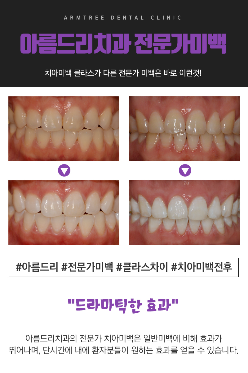 가수 치타 래퍼 강남 아름드리치과 방문 관련 이미지 6