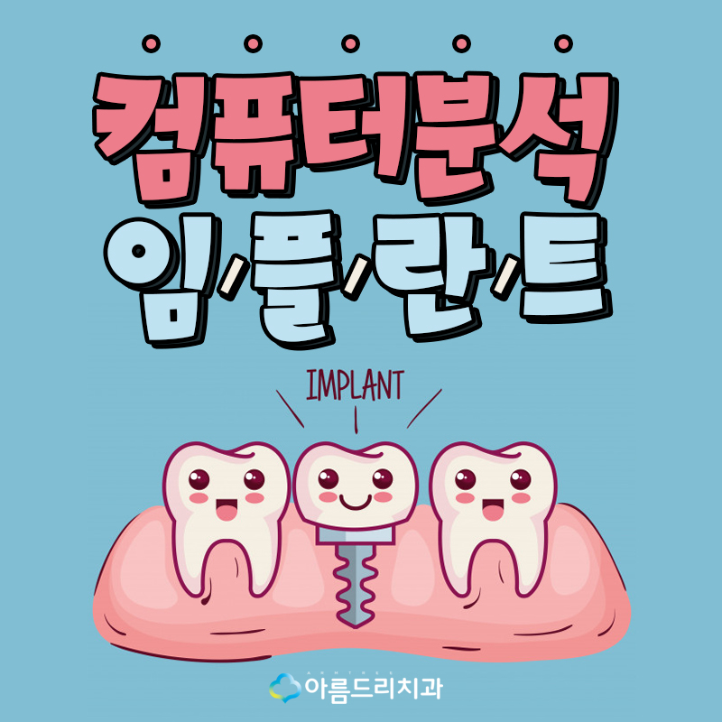 컴퓨터분석임플란트 디지털임플란트 왜? 관련 이미지 1