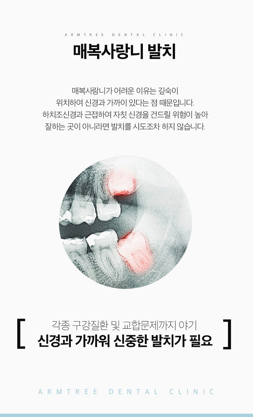 매복사랑니 발치후기통증 아름드리치과 관련 이미지 3