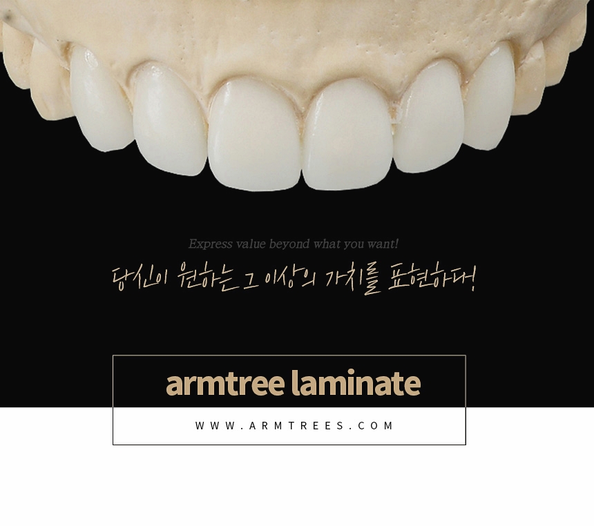 앞니라미네이트 부작용없는선택 아름드리치과 관련 이미지 9