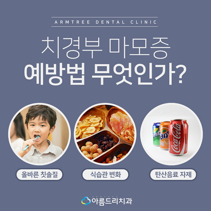 치경부마모증 잇몸파임 시린이 치료 관련 이미지 10