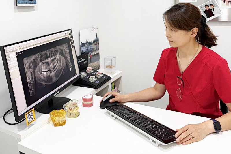 테일러비니어? 일반 라미네이트와 다른 점은 무엇일까요? 관련 이미지 2