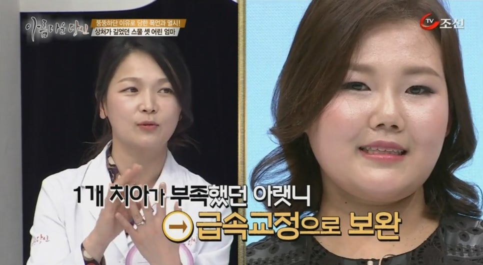 이현정원장의 아름다운 당신 시즌 2 (8회 최은경 도전자) 치아교정, 임플란트, 치아미백 관련 이미지 9