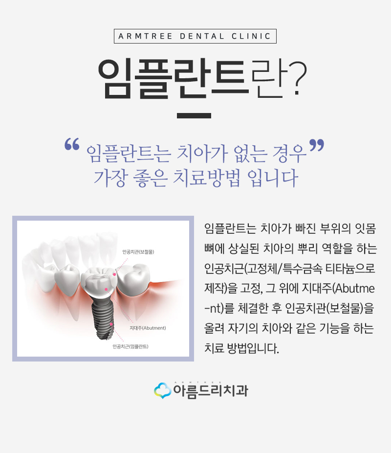 인플란트통증 걱정없는 디지털임플란트 관련 이미지 2