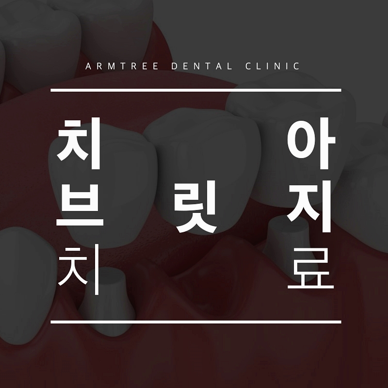 치아브릿지 가격 신논현역 아름드리치과 관련 이미지 1