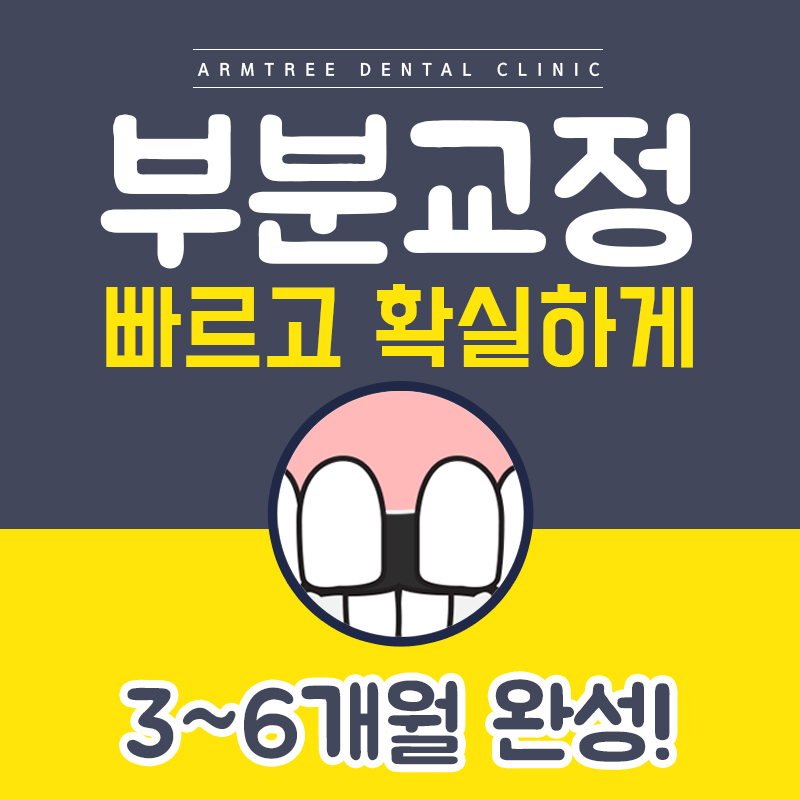 치아부분교정비용 앞니벌어짐교정 단기간에 관련 이미지 1
