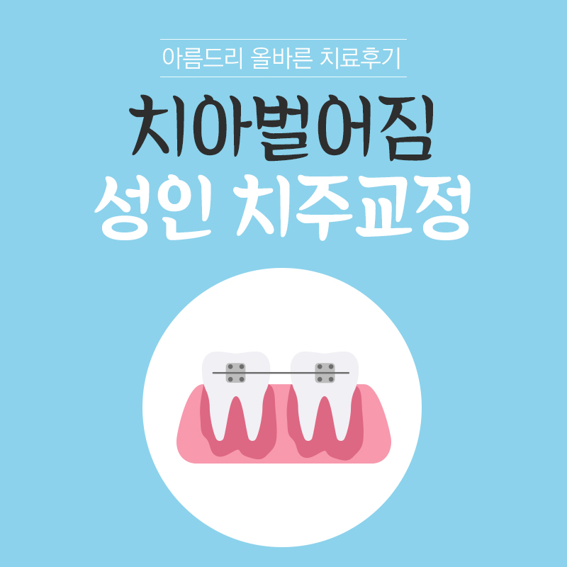 부분교정치과 후기 성인치주교정 관련 이미지 1