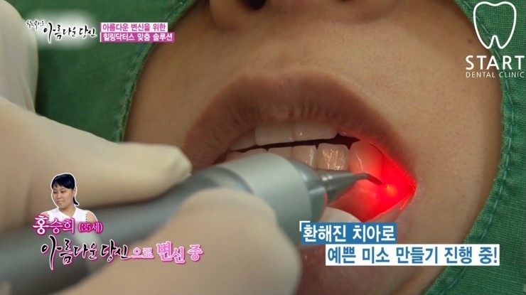 이현정 원장의 아름다운 당신 시즌 1 (9회 홍승희 도전자) 잇몸미백, 치아미백 관련 이미지 3