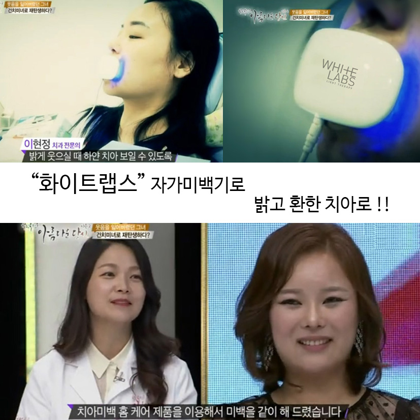 이현정원장의 아름다운 당신 시즌 2 (4회 김양경 도전자) 잇몸미백과 치아미백 관련 이미지 6