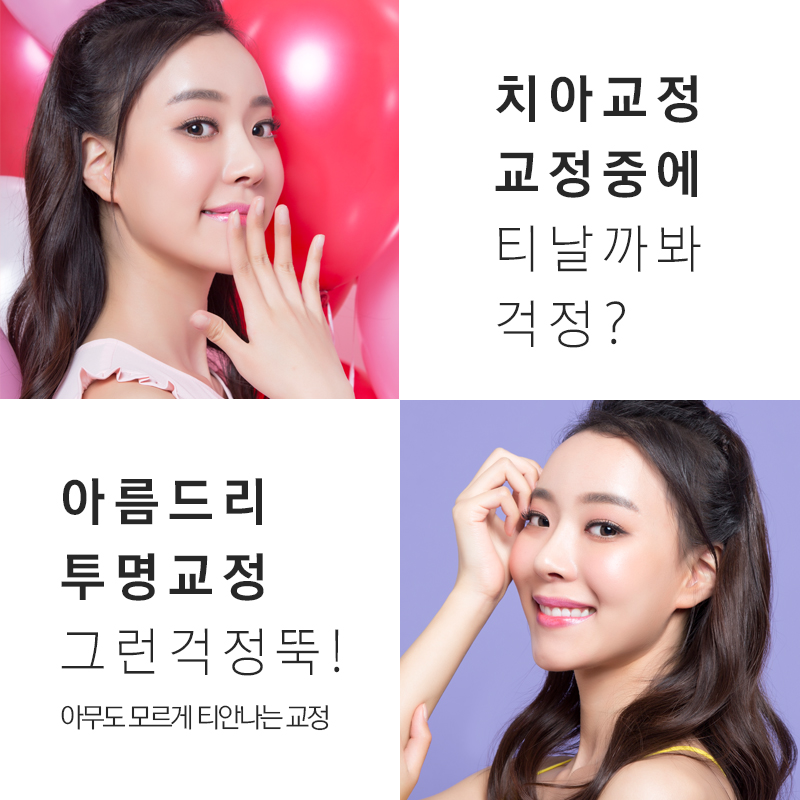 강남투명교정치과 앞니덧니 문제없음 관련 이미지 5