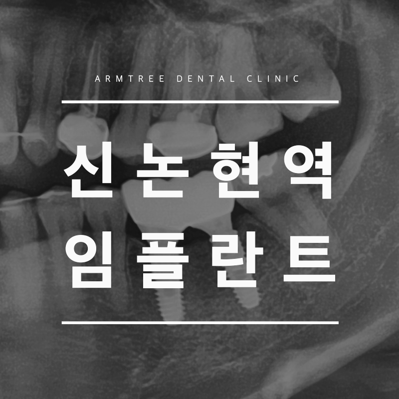 신논현역임플란트 오랫동안 사용하려면 관련 이미지 1