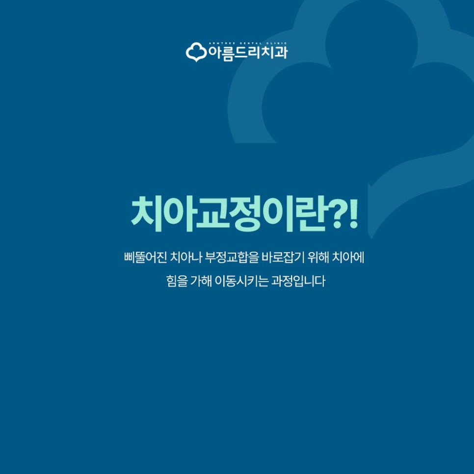 강남역 투명교정(인비절라인) VS 브라켓 교정 장단점 비교 관련 이미지 2