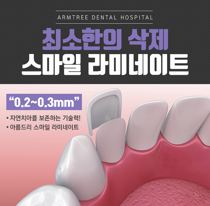 웃을때 입모양 단기간에 이뻐지자 관련 이미지 5