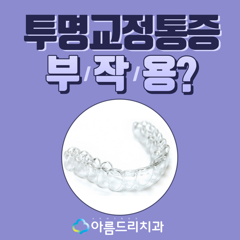 투명교정통증 부작용은 과연? 관련 이미지 1