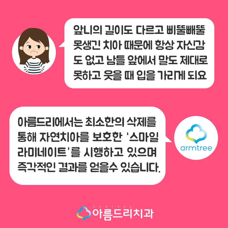 못생긴 앞니 치아라미네이트로 빠르게 관련 이미지 2