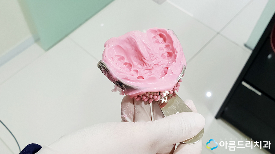 어린이치아교정 부정교합 리얼스토리#2 관련 이미지 5