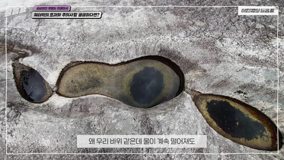 워터픽 효과와 효능 치아와 잇몸건강 #이현정의물음표 관련 이미지 12