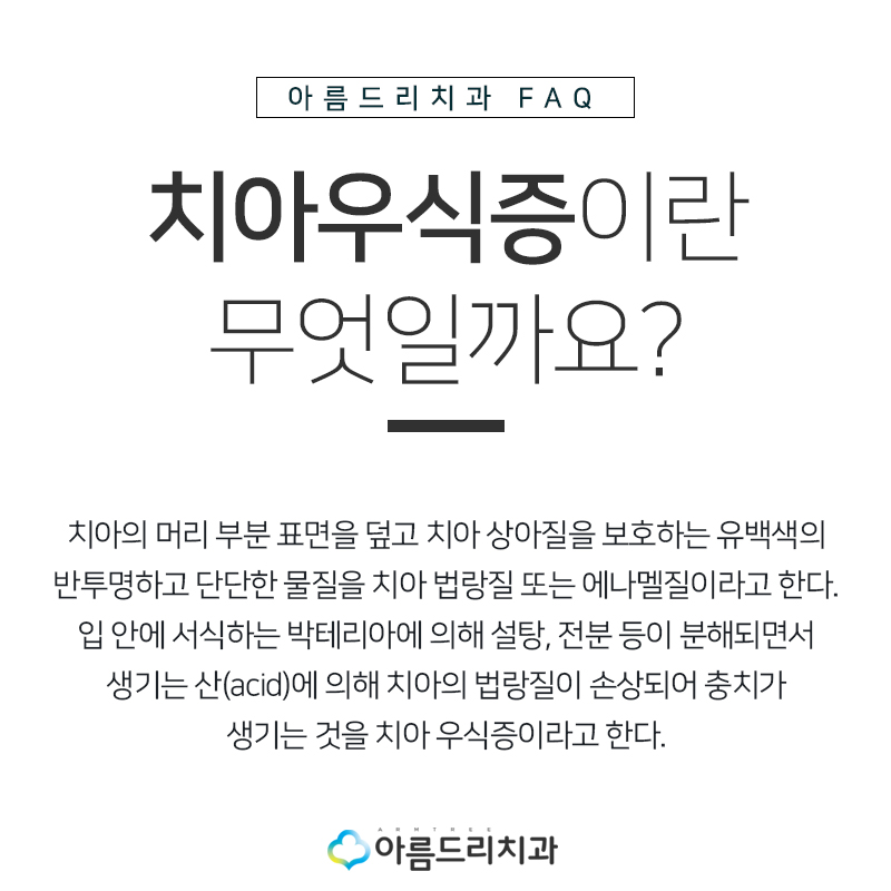 치아우식증 어금니충치 재충치치료 관련 이미지 5