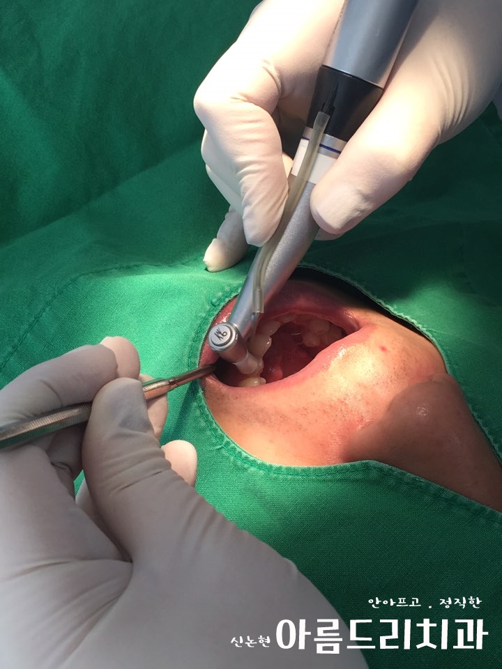 신논현역치과 아름드리치과에서 건강한 치아미백, 전문가 미백 관련 이미지 3