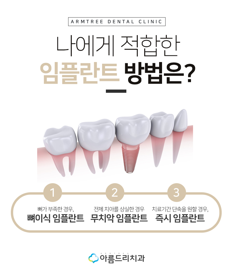 인플란트통증 디지털임플란트 좋은이유 관련 이미지 3