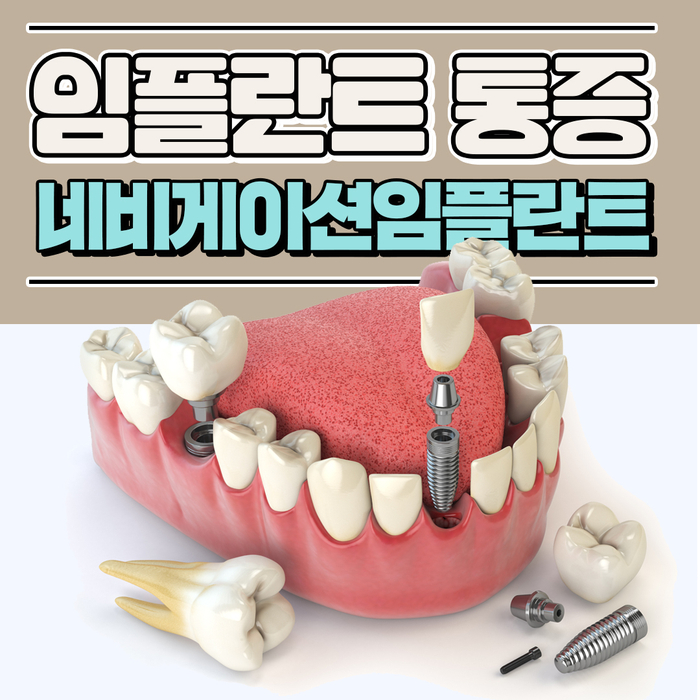 인플란트통증 디지털임플란트 좋은이유 관련 이미지 1