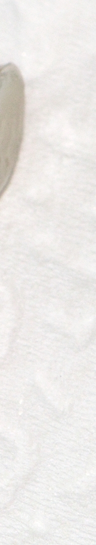 신논현치과 사랑니발치 치과는 신중하게 관련 이미지 11