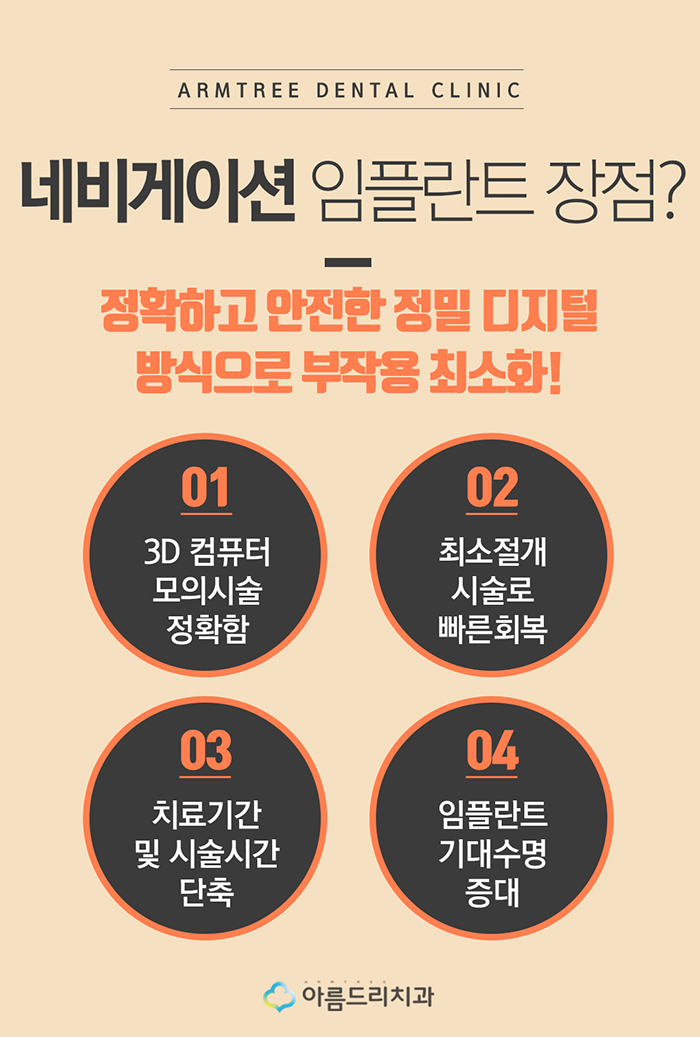 컴퓨터분석 임플란트 비용 아름드리 관련 이미지 6