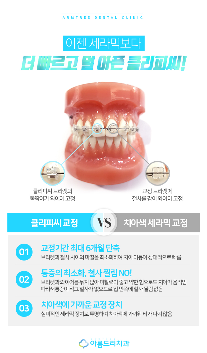클리씨피교정 자가결찰교정 아름드리 관련 이미지 4